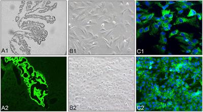 Conditioned Media of Choroid Plexus Epithelium Cells Attenuates High Pi-Induced Calcification of MOVAS Cells by Inhibiting ROS-Mediated Signal Pathways